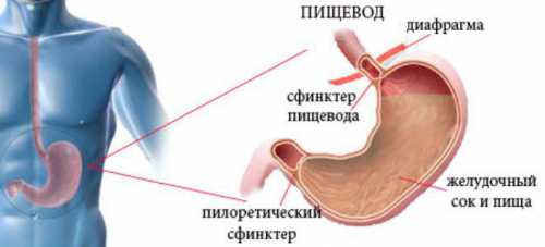 Гастроэзофагеальный рефлюкс с эзофагитом, без эзофагита